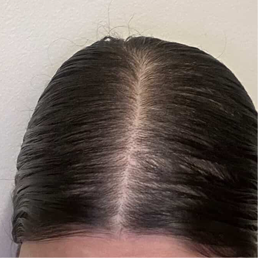 After: customer, 9 months