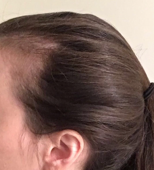 Before: customer