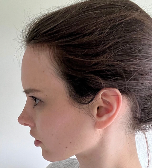 After: customer, 8 months