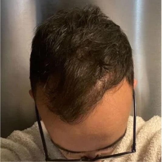 Customer hair after using Amazing Hair Saviour
