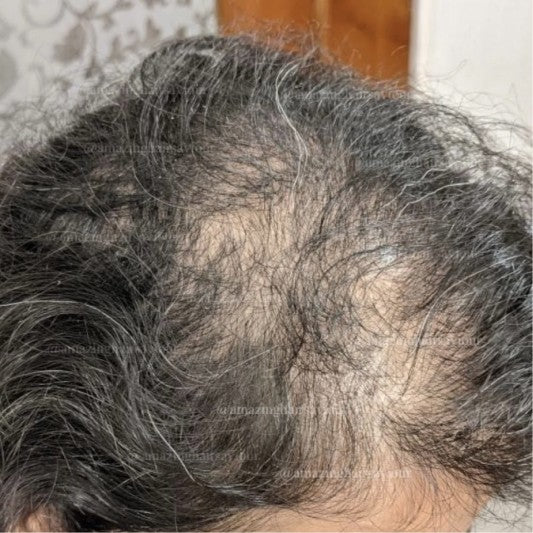 Customer hair before using Amazing Hair Saviour
