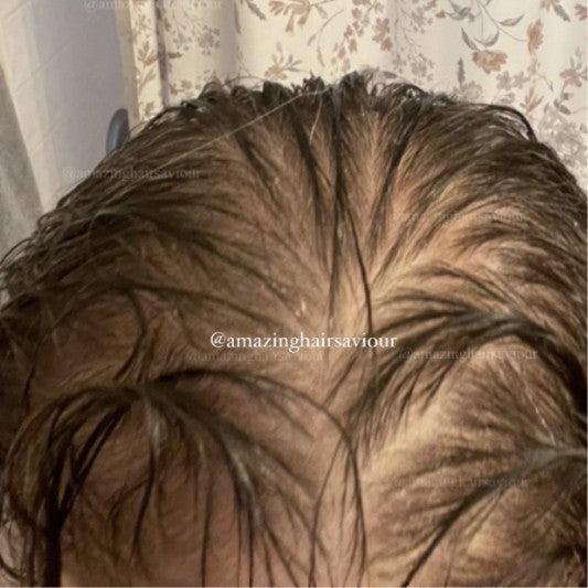 Customer hair before using Amazing Hair Saviour