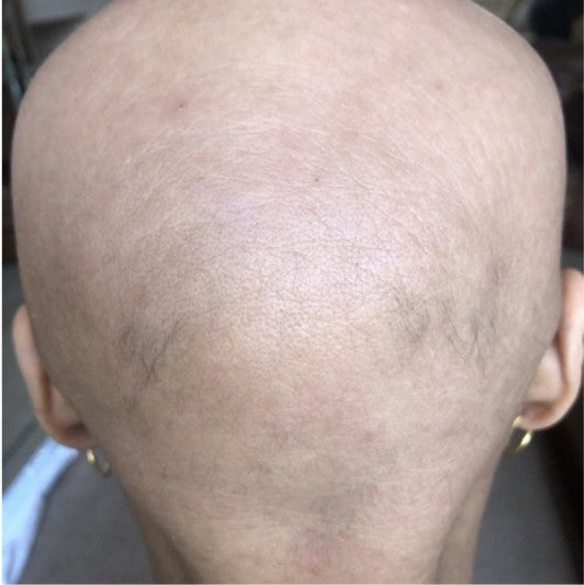 Customer hair before using Amazing Hair Saviour